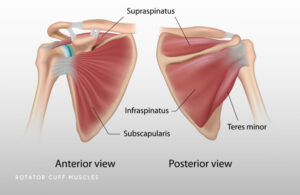 Rotator Cuff Tear Schaumburg Thomas Obermeyer Md